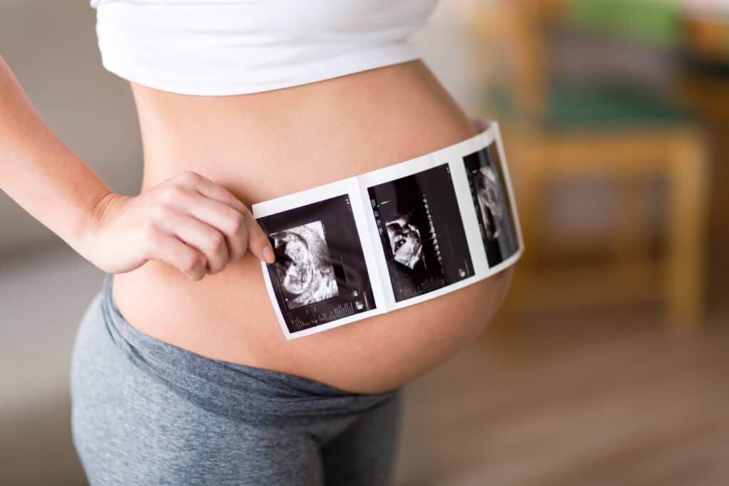 Pregnant woman holding ultrasound photo on belly