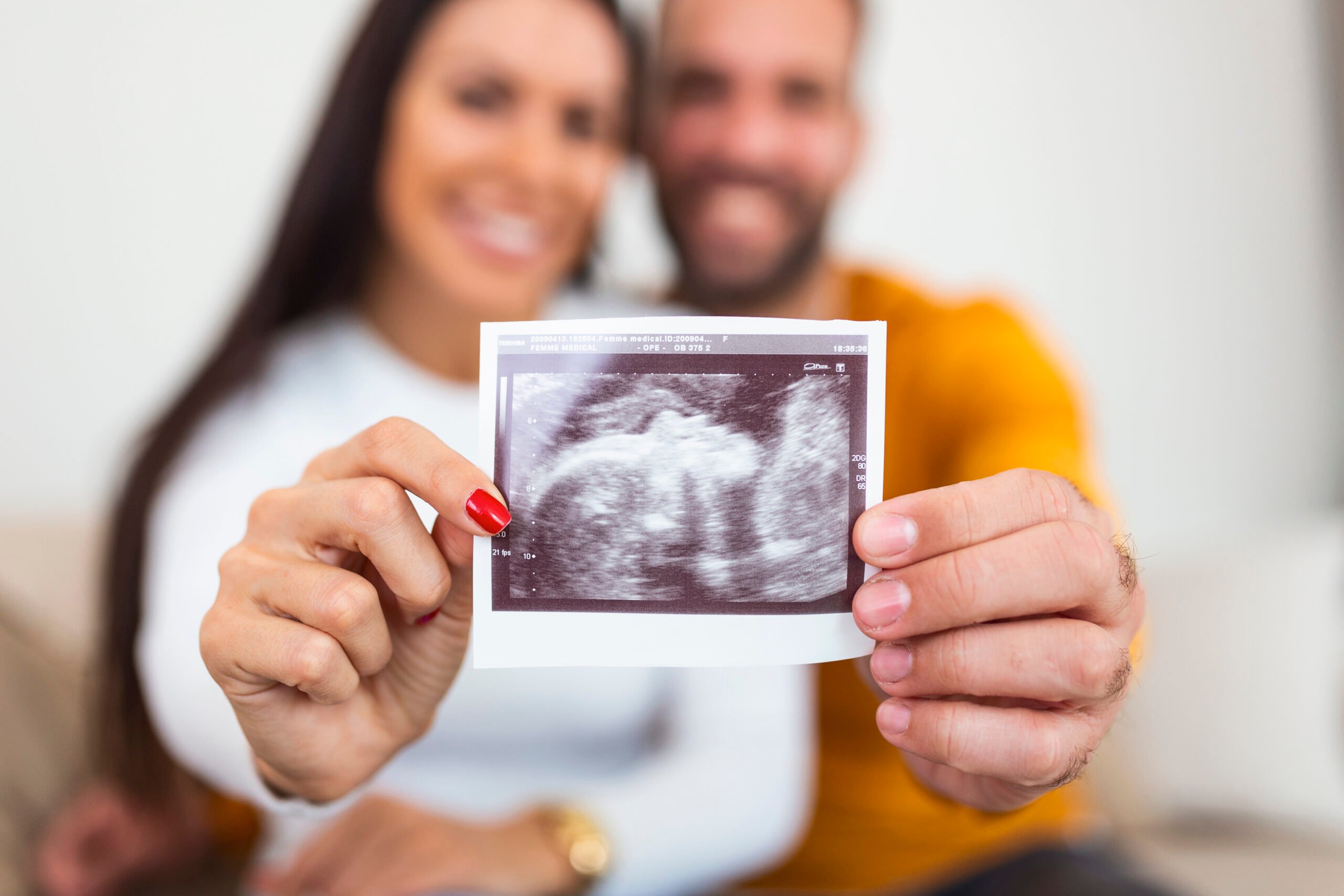 Young Pregnant woman and husband holding ultrasound scan photo and smiling.
