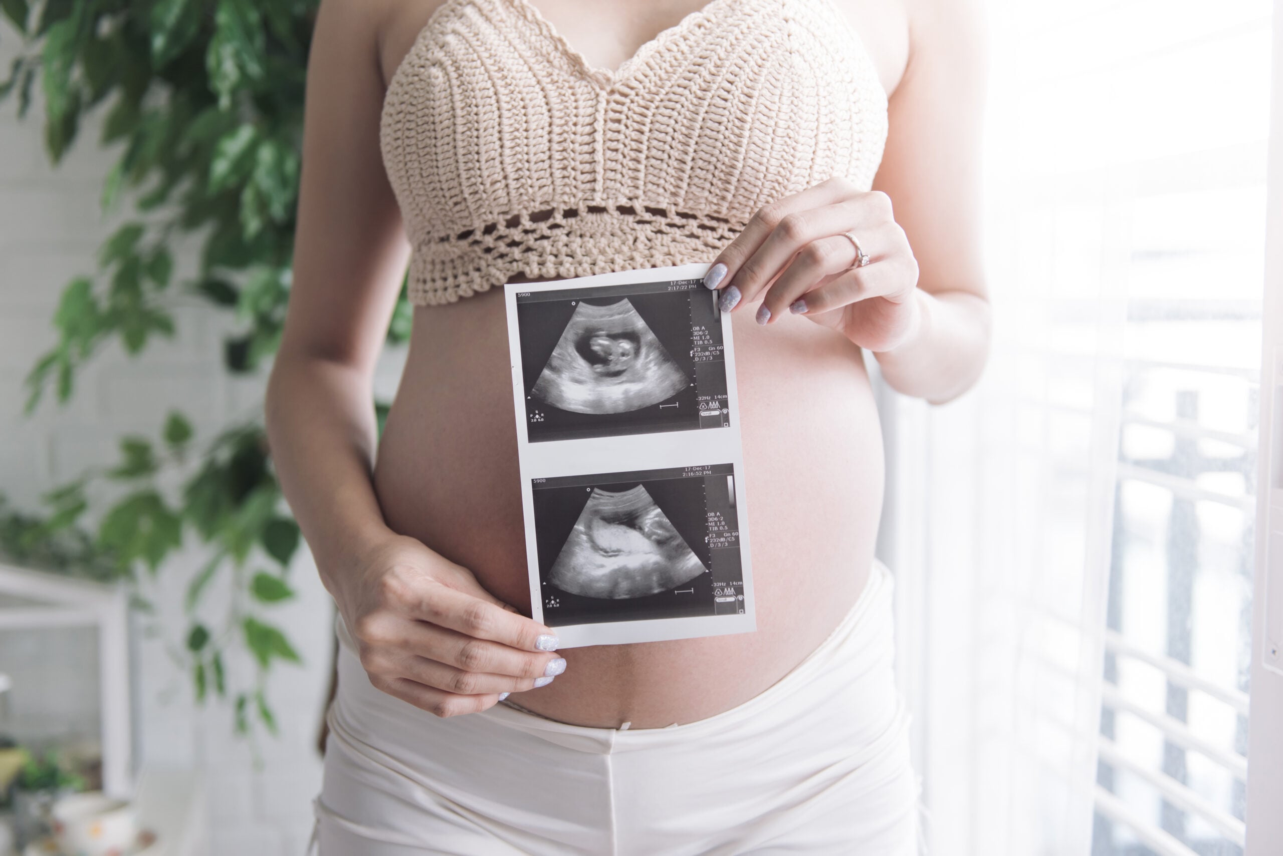 babyrealz_electiveultrasound__26